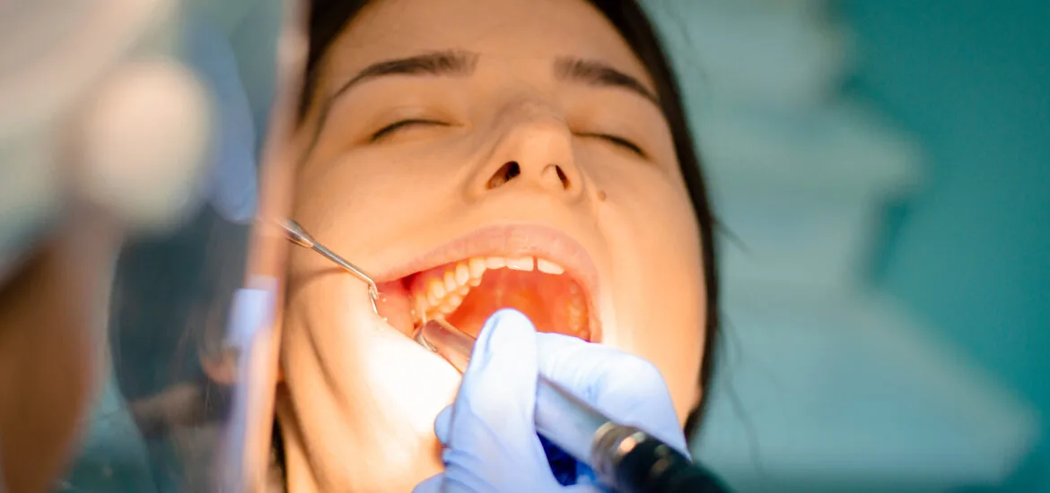 young woman having a tooth extracted in Lake Ozark