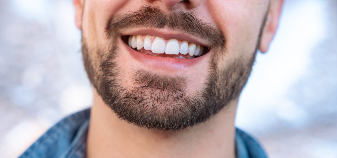 closeup of a bearded man with perfect white teeth
